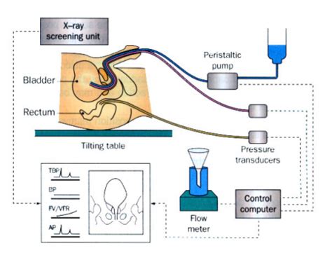 20k bladder tear test|bladder pressure testing procedure.